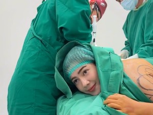 8 Foto Felicya Angelista Jalani Sedot Lemak, Makin Langsing Turun BB 2 Kg