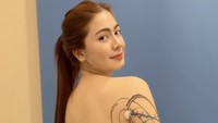 Sebelum melakukan prosedur LAMS, dokter lebih dulu menandai bagian tubuh Felicya yang lemaknya akan diangkat. Dokter melanjutkan proses dengan menyuntikkan antibiotik. Aktris berusia 30 tahun itu menegaskan prosedur yang dijalaninya bukan sedot lemak. Tindakan ini dilakukan oleh dokter bedah. Foto: Instagram @felicyangelista_