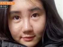 Foto Before-After Wanita Korea 400 Kali Operasi Plastik, Hasilnya Jadi Begini