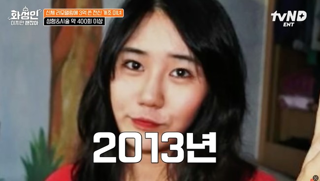 Dalam acara tersebut Gil membagikan transformasi dirinya dari tahun 2010 hingga saat ini. Meski tak signifikan, namun perubahan demi perubahan perlahan terlihat di wajah Gil. Foto: YouTube/tvN D ENT