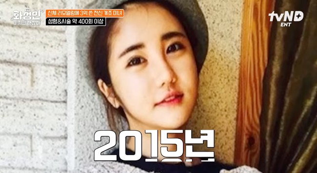 Gil sendiri mengungkapkan telah mengeluarkan sekitar 300 juta won atau sekitar Rp3,8 miliar untuk menjalani lebih dari 400 prosedur kecantikan selama 15 tahun terakhir. Foto: YouTube/tvN D ENT