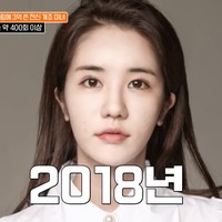 Beragam perawatan mulai dari fat grafting di dahi, operasi kelopak mata ganda, pembentukan hidung dan dagu, kontur wajah, hingga filler di leher, bahu, dan tulang selangka sudah pernah dijalani Gil. Ia bahkan menjalani liposuction revisi serta injeksi stem cell demi menjaga kesehatan kulit. Foto: YouTube/tvN D ENT