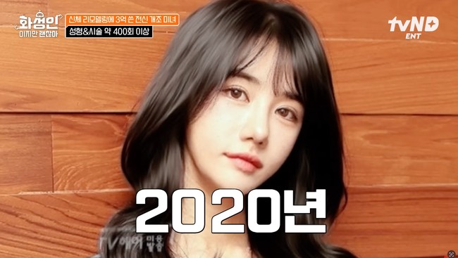 Gil mulai tertarik untuk menjalani oplas setelah sempat mengalami kenaikan berat badan dan mendapat komentar negatif dari orang sekitar serta mantan kekasihnya. Foto: YouTube/tvN D ENT