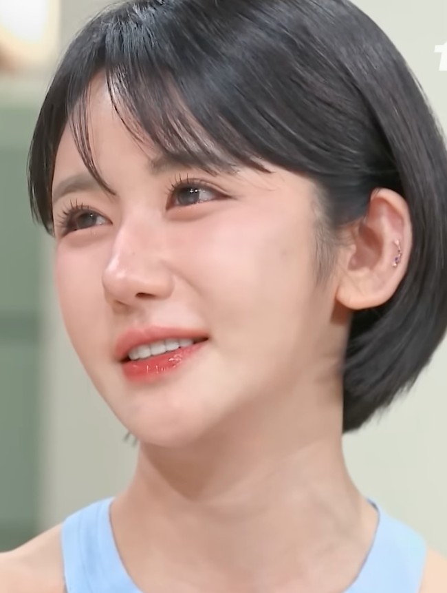 Wanita Ini Tempuh 400 Kali Operasi Plastik: Lihat 8 Fotonya Dari Masa ke Masa