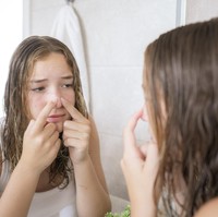 Apakah Jerawat di Bawah Hidung Boleh Dipencet? Ini Fakta yang Wajib Tahu!