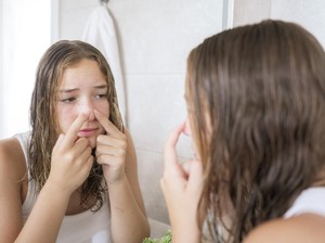 Kulit Berjerawat? Ini Alasan Harus Pakai Skincare Berbahan Dasar Air
