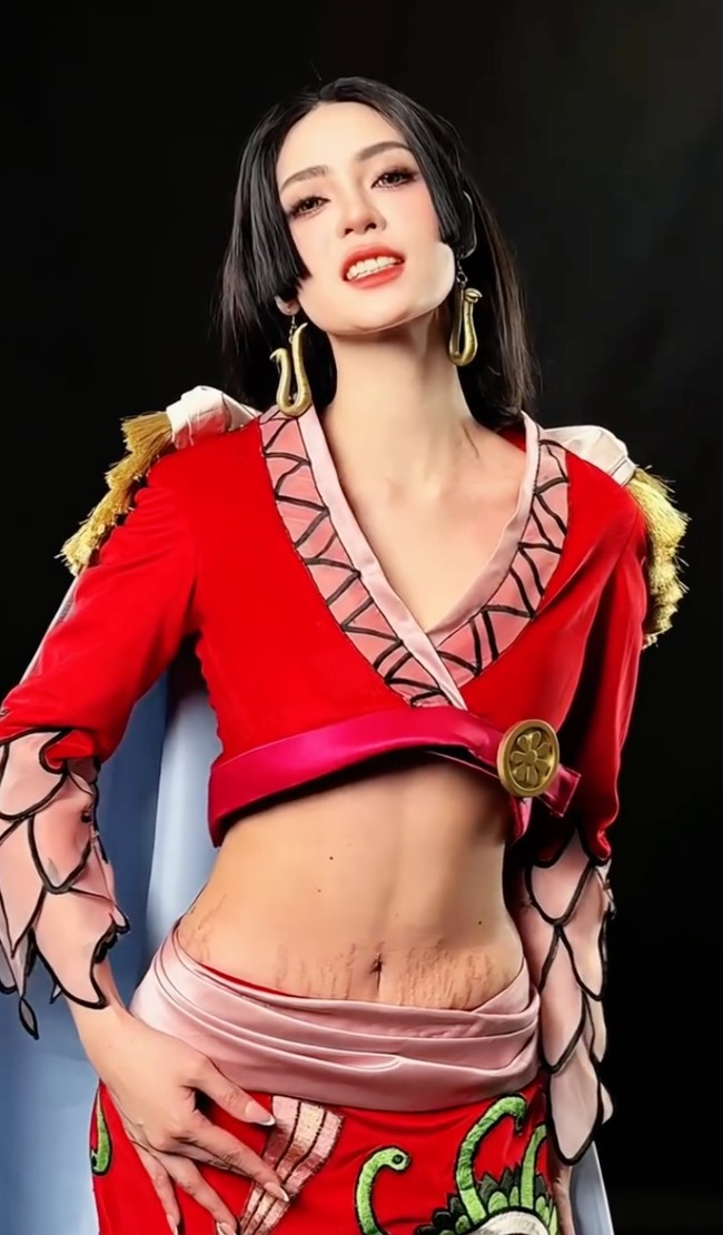 Penampilan Tamara yang penuh percaya diri memamerkan perut penuh stretch marks menginspirasi banyak netizen. Strechmark nya sih bikin tambah keren, malah lebih gong bgttttt, komentar salah seorang netizen. Wanita pertama yg bikin wanita lain pede with stretchmark, tambah netizen lain. Foto: Instagram/@tamaradai