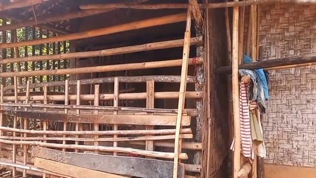 Wanita mengalami gangguan kejiwaan di Tenjo, Kabupaten Bogor terpaksa dipasung. Pihak keluarga punya keterbatasan biaya berobat. (dok Istimewa)