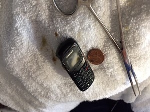 Aksi Nekat Napi Telan Ponsel hingga Nyangkut di Lambung, Begini Endingnya