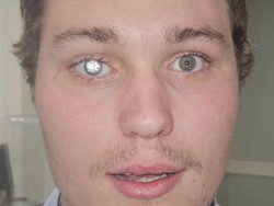 Viral Pria Pasang Berlian 2-Karat di Mata, Tatapannya Bikin Silau