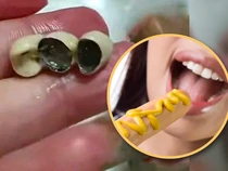 Bikin Mual! Pelanggan Temukan Gigi Manusia di Kue dan Sosis