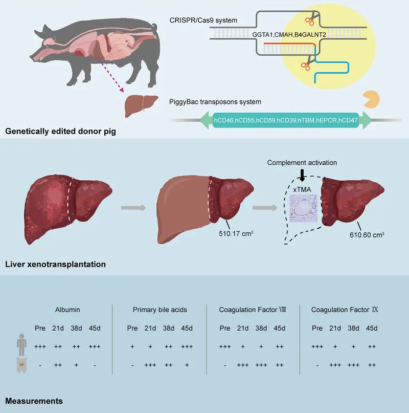 Skema yang mengilustrasikan bagaimana penyuntingan genetik dilakukan menggunakan CRISPR/Cas9, bagaimana operasi berlangsung, dan berbagai penanda yang diukur pada pasien.