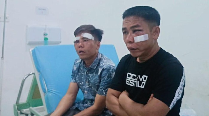 Kades Cahaya Bumi OKI dan saudaranya alami luka serius usai dianiaya.