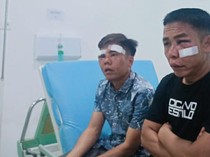 Kades di OKI Diduga Dianiaya Oknum TNI, Korban Alami Luka Serius
