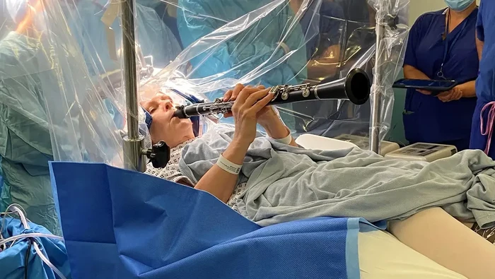 Seorang pasien Parkinson, Denise Bacon (65), memainkan klarinetnya saat menjalani prosedur bedah otak Deep Brain Stimulation (DBS) di King’s College Hospital.