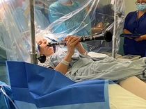 Pasien di Inggris Jalani Operasi Otak Sambil Main Klarinet