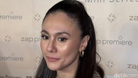 Wulan Guritno Tanggapi Wajah Bopengnya yang Viral, Akui Jadi Pejuang Jerawat Wulan Guritno Tanggapi Wajah Bopengnya yang Viral, Akui Jadi Pejuang Jerawat