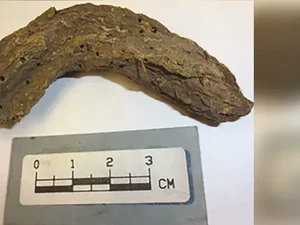 Seram! Kotoran dari 1.300 Tahun Lalu Bongkar Penyakit Zaman Kuno