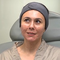 Karena wajahnya itu, Wulan mengaku sempat tak percaya diri, terutama karena dirinya bekerja di dunia hiburan. Ya aku sendiri yang insecure aja gitu, ngelihat muka-muka mereka mulus-mulus, nggak ada pori-pori gitu, terus di make-up itu cepat, kalau aku kan dempul lama banget gitu, terangnya. Foto: ZAP Premier