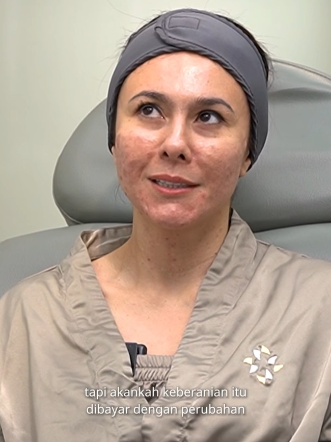 Karena wajahnya itu, Wulan mengaku sempat tak percaya diri, terutama karena dirinya bekerja di dunia hiburan. Ya aku sendiri yang insecure aja gitu, ngelihat muka-muka mereka mulus-mulus, nggak ada pori-pori gitu, terus di make-up itu cepat, kalau aku kan dempul lama banget gitu, terangnya. Foto: ZAP Premier