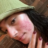 Salah satu artis yang juga dikenal sebagai seorang pejuang jerawat ialah Tatjana Saphira. Tetap percaya diri, Tatjana sempat beberapa kali membagikan wajah aslinya yang dipenuhi jerawat. Foto: Instagram