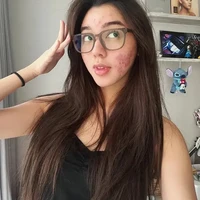 Artis Gabriella Ekaputri sempat jadi sorotan karena keberanian dan kepercayaan dirinya memamerkan wajah aslinya yang dipenuhi jerawat dan kemerahan. Unggahannya itu pun langsung banjir dukungan dari para netizen. Foto: Instagram