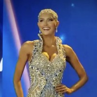 Mary yang biasanya tampil dengan wig, memilih untuk menunjukkan penerimaan dirinya yang berani tanpa rambut. Penampilannya tetap elegan dengan hiasan bling-bling di seluruh kepalanya.  Foto: dok. Instagram @mary_sickler