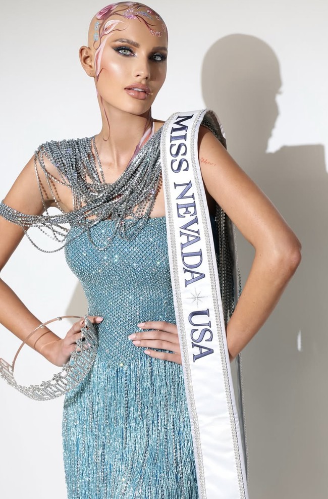Wanita 22 tahun itu menjadi kontestan pertama dengan diagnosa alopedia yang berkompetisi di Miss USA. Saya kehilangan semua rambut saya, dan saya sama sekali tidak menyangka akan berjalan di panggung Miss USA tanpa rambut, tetapi kenyataannya memang begitu, ujar Mary, seperti dikutip People. Foto: dok. Instagram @mary_sickler