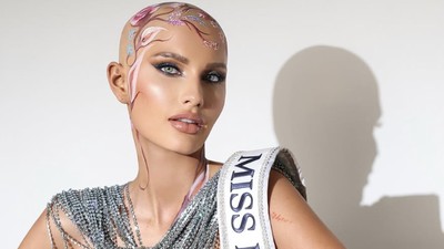 Foto Finalis Miss USA 2025 yang Botak, Jalan di Panggung Tanpa Wig