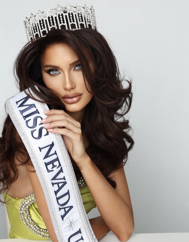 Mary mengalami kehilangan bulu, hampir di seluruh tubuhnya, bahkan bulu matanya. Ia bahkan tidak memiliki alis. “Sejujurnya, saya tidak bisa mengenali diri saya sendiri lagi, kenangnya setelah penampilannya berbebda.  Foto: dok. Instagram @mary_sickler