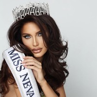 Mary mengalami kehilangan bulu, hampir di seluruh tubuhnya, bahkan bulu matanya. Ia bahkan tidak memiliki alis. “Sejujurnya, saya tidak bisa mengenali diri saya sendiri lagi, kenangnya setelah penampilannya berbebda.  Foto: dok. Instagram @mary_sickler