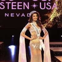 Mary yang merupakan seorang model itu mengaku pada awalnya sangat terpuruk setelah didiagnosa alopecia. Namun akhirnya dia memilih untuk bangkit. Foto: dok. Instagram @mary_sickler