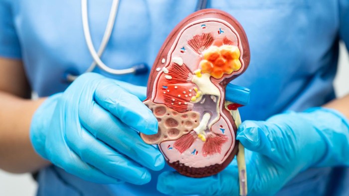 Perubahan Warna Urine: Tanda-Tanda Gagal Ginjal yang Perlu Diwaspadai