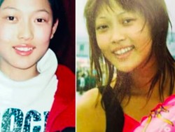 Wanita Ini Hampir Mati Setelah Oplas 300 Kali, Penampilannya Bikin Shock!