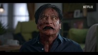 Film Zombie Abadi Nan Jaya di Netflix Bisa Picu Trypophobia, Apa Itu? Film Zombie Abadi Nan Jaya di Netflix Bisa Picu Trypophobia, Apa Itu?