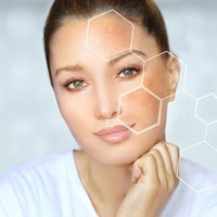 Kulit Kemerahan karena Jerawat? Ini Cara Menenangkannya Tanpa Iritasi