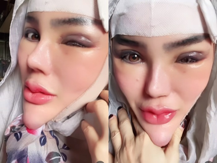 TikTokers dan PNS Lampung, Yuni Jasmine mengunggah video wajahnya tanpa tambahan filter di TikTok mendadak viral dan menjadi sorotan warganer.