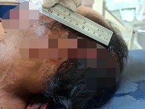 Warga Lombok Timur Ditebas 2 Saudara Kandung gegara Sengketa Tanah Warisan