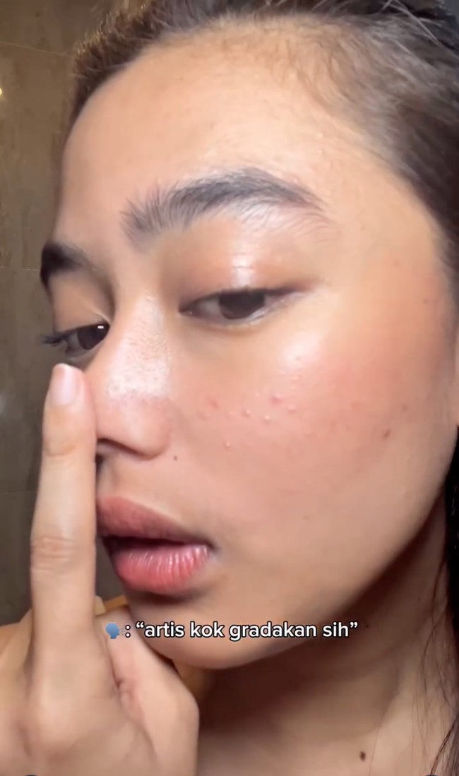 Dalam salah satu unggahan videonya, Aqeela bahkan tak ragu untuk memamerkan wajahnya yang tak mulus dan terlihat bruntusan. Foto: Instagram/@aqeelacalista