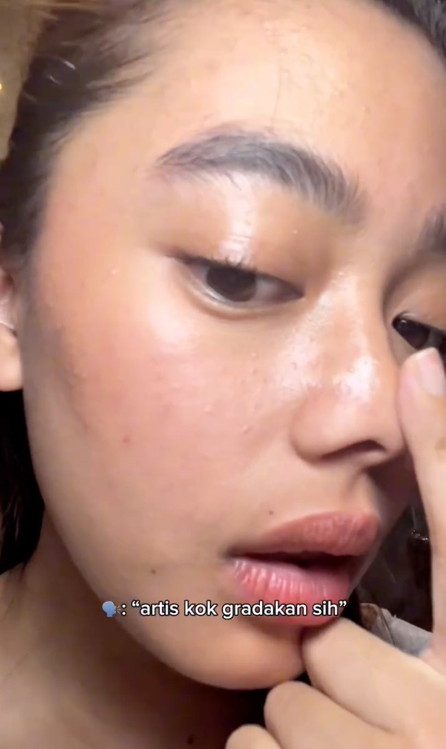 Dengan penuh percaya diri ia memamerkan sisi kiri dan kanan pipinya yang tak mulus. Meski demikian Aqeela tetap terlihat cantik dan unggahannya pun banjir pujian netizen. aqelaaaa cantikkk, tulis salah satu komentar. Foto: Instagram/@aqeelacalista