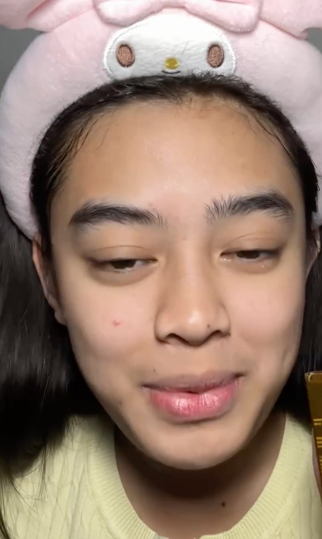 Seperti layaknya kebanyakan remaja, Aqeela juga mengalami masalah jerawat, komedo, dan bruntusan pada wajahnya. Namun hal itu tak lantas menurunkan rasa percaya dirinya. Foto: Instagram/@aqeelacalista