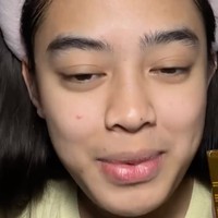 Seperti layaknya kebanyakan remaja, Aqeela juga mengalami masalah jerawat, komedo, dan bruntusan pada wajahnya. Namun hal itu tak lantas menurunkan rasa percaya dirinya. Foto: Instagram/@aqeelacalista