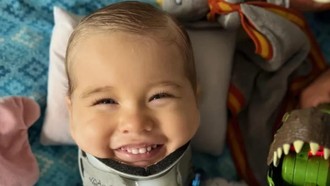 Bak Mukjizat, Kepala Balita Terpisah dari Tulang Belakang Bisa Disambung Lagi Bak Mukjizat, Kepala Balita Terpisah dari Tulang Belakang Bisa Disambung Lagi