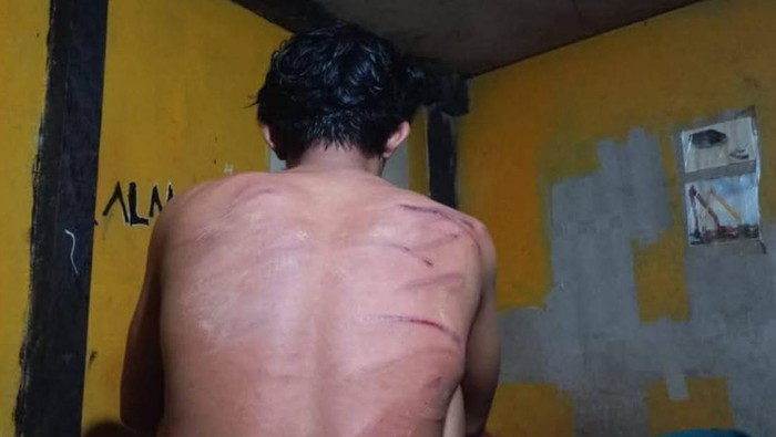 Kondisi korban yang diduga dianiaya anggota TNI BKO di PT RIM. (Istimewa) Kondisi korban yang diduga dianiaya anggota TNI BKO di PT RIM. (Istimewa)