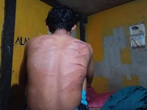 2 Karyawan PT RIM Diduga Dianiaya Oknum BKO TNI