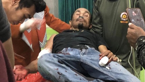 Foto : SY, (44) korban pembacokan SF (42) yang ditangani medis Puskesmas Lambu, Kabupaten Nima, NTB, Rabu, (29/10/2025). (Istimewa)