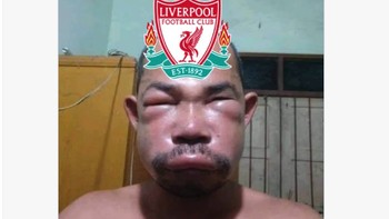 Atau ada yang begini karena habis menangisi kekalahan semalaman. Foto: X.com