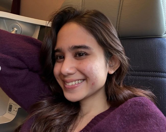 Tanpa ditutup makeup, terlihat jelas kemerahan jerawat serta bruntusan di pipinya. Meski sedang berjerawat namun Tissa tetap tercaya diri. Penampilan Tissa pun banjir pujian. Foto: Instagram/@tissabiani