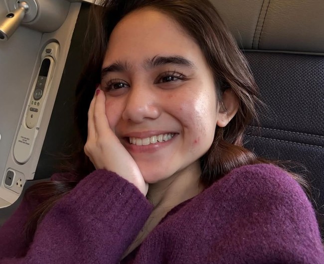 Bukan kali pertama, sebelumnya artis 23 tahun itu memang lebih sering tampil natural memamerkan wajahnya tanpa makeup. Ia juga sempat mengaku menjadi pejuang jerawat selama 4 tahun. Foto: Instagram/@tissabiani