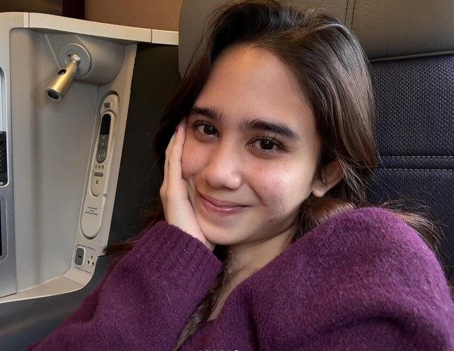 Meski memiliki kulit yang mudah berjerawat namun hal itu tak lantas membuat Tissa malu untuk memamerkan wajah aslinya. Terbukti meski dengan adanya jerawat, Tissa tetap terlihat cantik. Foto: Instagram/@tissabiani